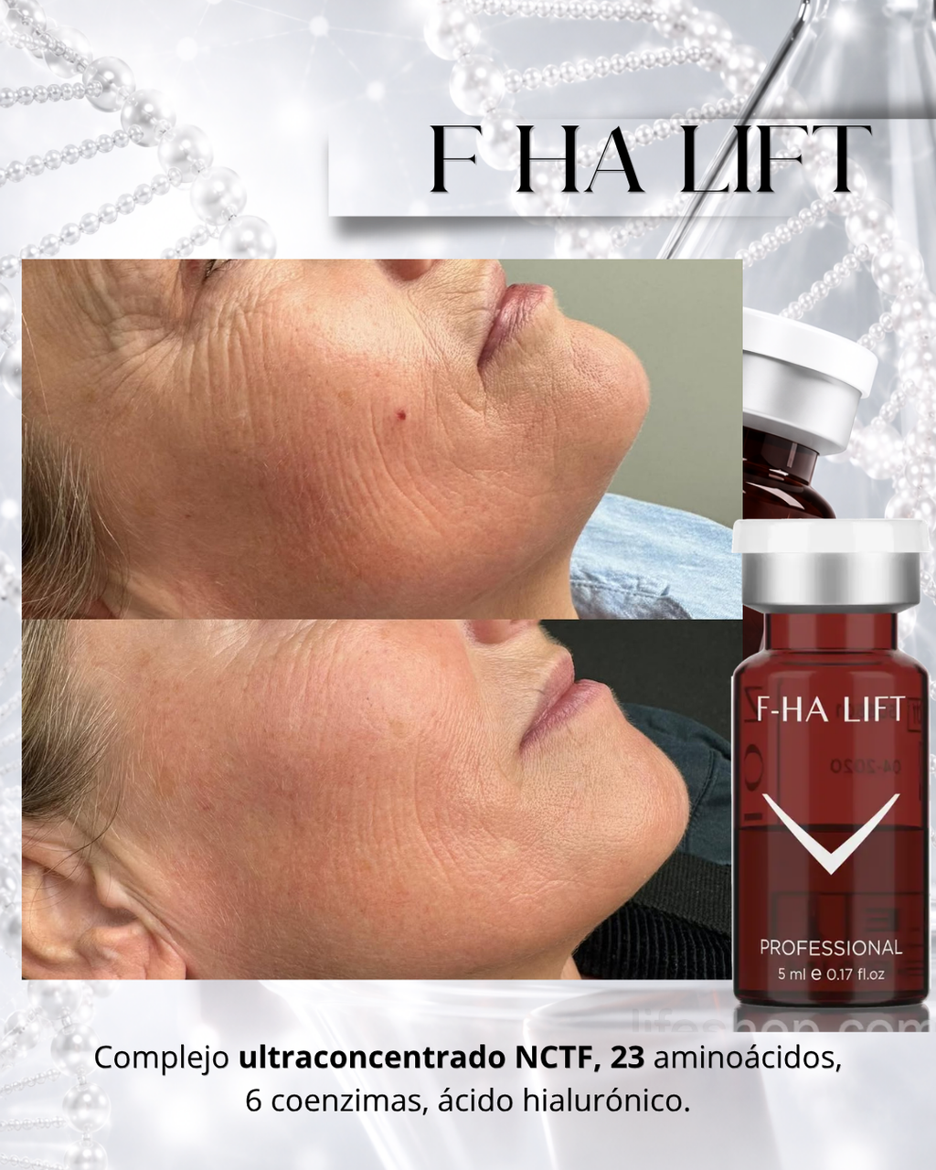 F HA Lift
